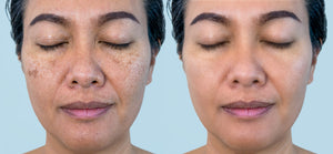 NuVida Micro-Infused Renewal Kit - 2 Months