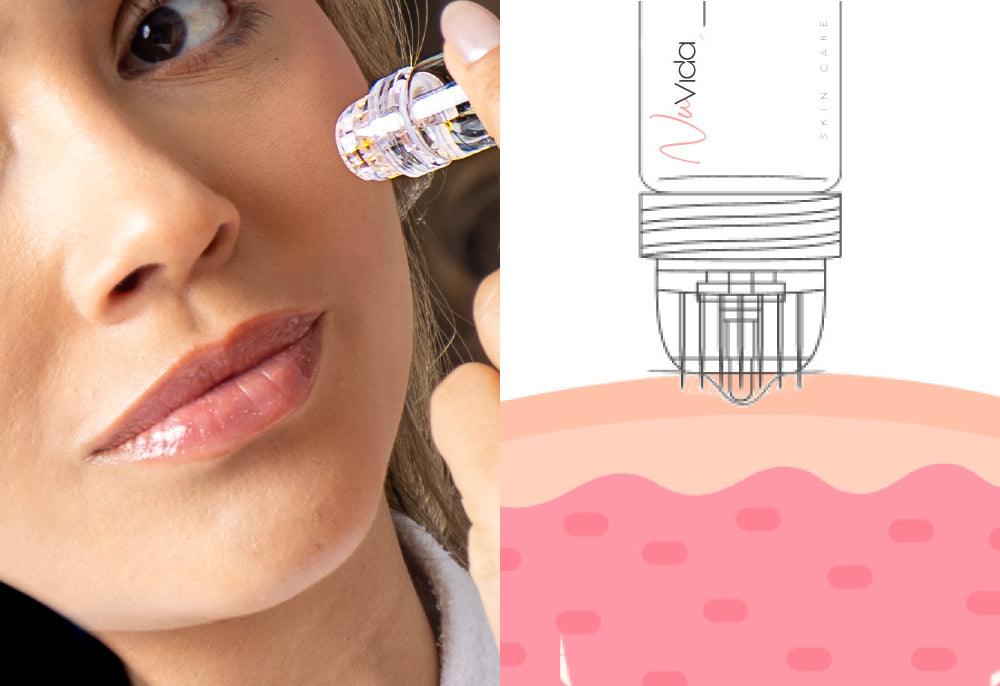 NuVida Micro-Infused Renewal Kit -